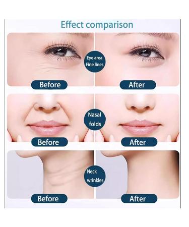 Japanese Face Tape for Wrinkles | Anti-Wrinkle & Face Lifting Beauty Patch | Toning & Firming Skin Solution - Buy Online on GoSupps.com