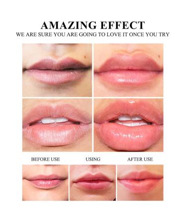 Moisturizing Plant Extract Lip Balm Hydrating Lip Oil Moisturizing Lip Tint Lipgloss Essence (Multicolor) - Buy Online on GoSupps.com