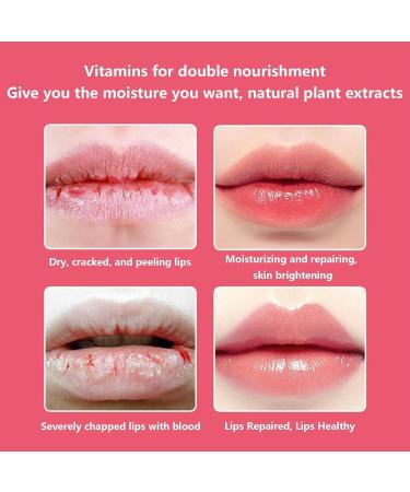 Lip Balm | Honey Lip Balm | Natural Formula Lip Moisturizer with Vitamin E All Day Moisturizing Lip Balm Hydrates Dry Chapped Lips Aokley - Buy Online on GoSupps.com