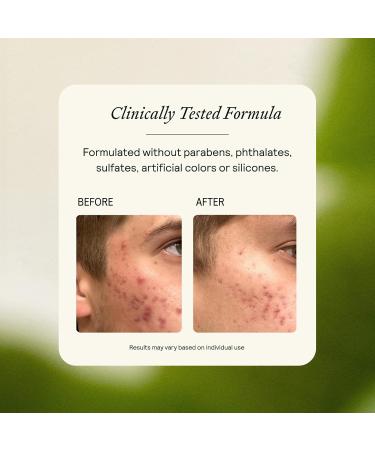 EQ Gentle Cleanser - EGCG + Quercetin - Gentle Face Wash - Cleanse & Purify Skin - For Redness & Blemishes - With Squalene Oil - Lightweight Plant-Based Formula - 4.05 fl oz 1 Count (Pack of 1) - Buy Online on GoSupps.com