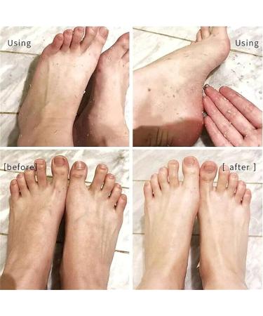 Foot Peeling Spray Orange Oil Exfoliating Foot Moisturizing Hydrating Nourish Peel Off Spray Remove Dead Skin And Calluses On Feet Gentle Foot Care. (Green Tea) - Buy Online on GoSupps.com
