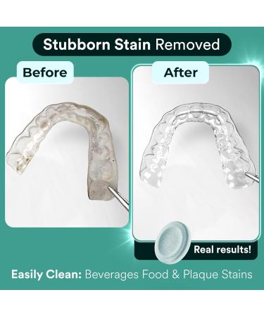 Buy Persulfate Free Retainer Cleaner Tablets - 60 Mint Scented Tablets for Invisalign Dentures & Night Guards - Effective Odor & Stain Removal - 2 Months Supply - Buy Online on GoSupps.com