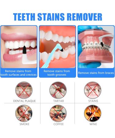Quelcc 3-Piece Toothbrush Set | Stain & Tartar Remover | Soft Ricket Brush for Professional Tooth Cleaning | Remove Discoloration & Plaque - Buy Online on GoSupps.com