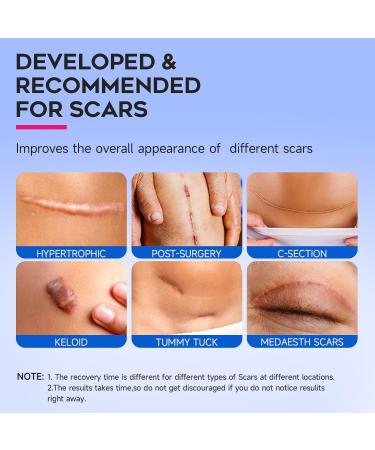 Thicker Silicone Scar Sheets - Medical Grade Scar Tape for Surgical Scars Keloids and Burns | Effective & Strong Adhesion (1.6 x 118 - Buy Online on GoSupps.com