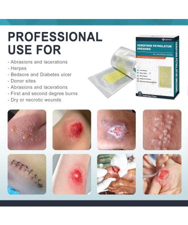 CEEPORT Medical Xeroform Petrolatum Dressing 5x9 - Pack of 25 Non-Adherent Gauze Pads for Wound Care, Burns, Lacerations & Skin Grafts - Buy Online on GoSupps.com