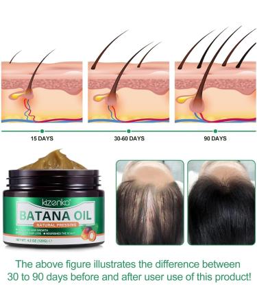 JSBNQRMZ Batana Oil for Hair Growth 120 Grams Solid Batana Oil 100% Wild Growth Hair Oil as Hair Mask Scalp and Hair Oil- Repairs Damaged Hair & Skin Reduces Hair Loss Healthier Hair Growth - Buy Online on GoSupps.com