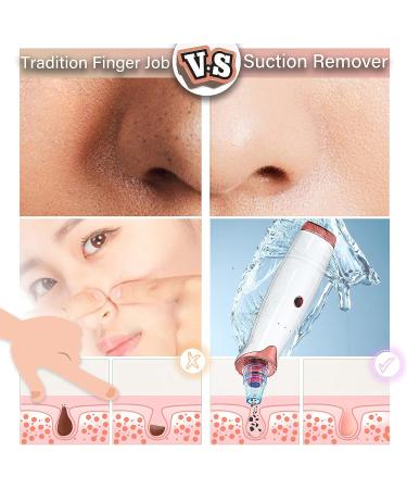 TALLPLUS Blackhead Remover Pore Vacuum - Electric Facial Cleaner for Acne & Whitehead Extractor - USB Rechargeable with 3 Levels of Suction Power - Buy Online on GoSupps.com