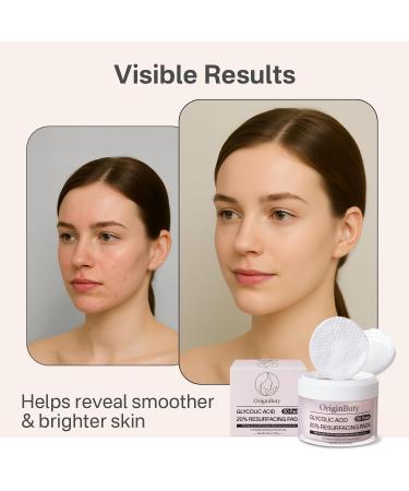 Glycolic Acid 20% Resurfacing Pads (50 Count), Exfoliating Peel Pads for Face, Skin Pore Resurfacing & Radiance, Exfoliating Toner Facial Pads with Oil, Salicylic Acid & Vitamins E, B3, B5 Pink 50 Count (Pack of 1) - Buy Online on GoSupps.com