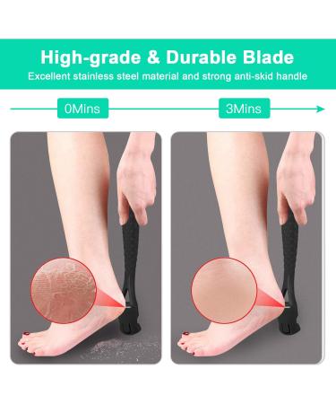 Premium Stainless Steel Foot Care Set for Dry Wet Foot Heel Callus Removal - Buy Online on GoSupps.com