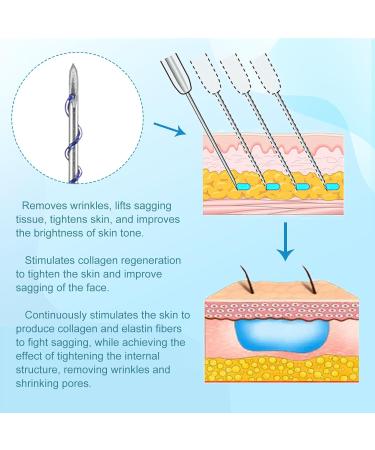 Minovd PDO Thread for Facelifting - 27G 50mm V-Lifting Screws | 40 Pieces Professional Anti-Aging Solution - Buy Online on GoSupps.com