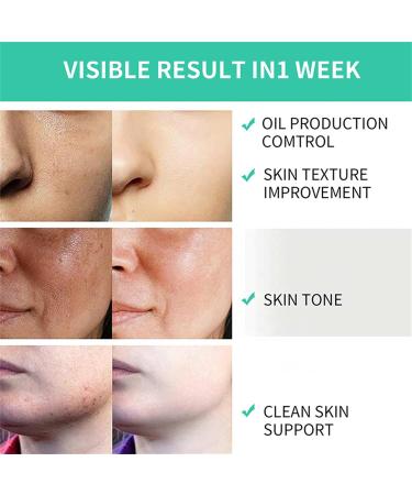 35% Glycolic Acid Peel Pads Exfoliating Face & Body Wipes with B5 & Tea Tree Oil for Pore Minimizing & Even Skin Tone - 1Pcs 2.82oz - Buy Online on GoSupps.com