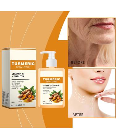 Turmeric Body Lotion Turmeric Body Lotion Improve Skin Tightening Deep Hydration Repair Dry Skin Turmeric Body Treatment Lotion For Smooth Skin (3) - Buy Online on GoSupps.com
