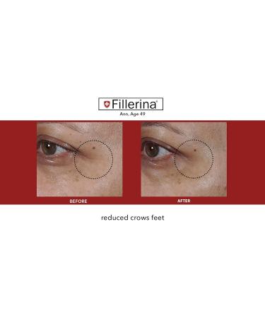 Fillerina 12 Densifying-Filler - Intensive Filler Treatment Grade 3 (2x30ml) - Buy Online on GoSupps.com