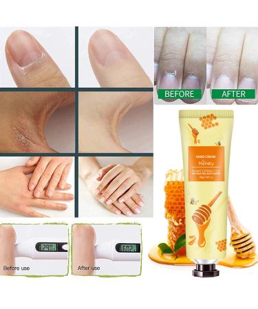 10 Pack Natural Plant Fragrance Hand Cream Gift Set for Dry Cracked Hands - Moisturizing Mini Lotion for Travel - Perfect Gift for Mom & Grandma - Buy Online on GoSupps.com