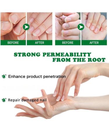 FLLUOUZH 3 PCS 7 Days Ginger Nail Ginger Nail Treatment Nail Support Nail Care Ginger Nail Growth Serum Ginger Cuticle Care Oil for Nails Nail Strengthener for Damaged Nails - Buy Online on GoSupps.com