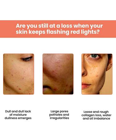 Dragon Blood Facial Cream Nicotinamide Anti Aging Dragons Blood Face Cream Toning cream Rosacea Cream For Face Face Moisturizer For Women Promote Collagen Brighten & Repair Anti Redness Firming - Buy Online on GoSupps.com