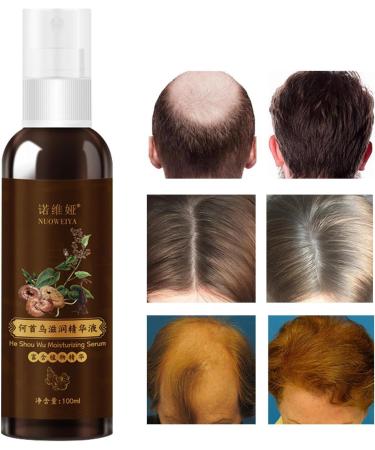  Linsition Thickening Hair Oil | He Shou Wu Hair Care - 100ml Deep Moisturizing Anti-Hair Loss Oil Strengthening and Regrowth Hair Oil - Buy Online on GoSupps.com