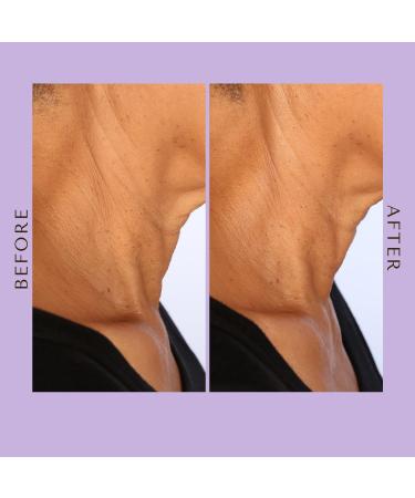 PRAI Ageless Jawline Uplift Serum Pump - Firm Lift and Sculpt Your Youthful Tight Jawline with Hyaluronic Acid Serum for Face | Jawline Face Serum in 30ml - Buy Online on GoSupps.com