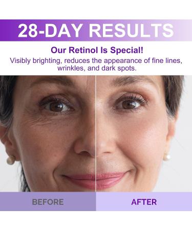 ZealSea 3.5% Retinol Facial Serum - Anti-Aging & Brightening Formula with Niacinamide, Collagen, and Hyaluronic Acid - 1 Fl.oz - Buy Online on GoSupps.com