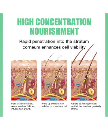 MZKJ.Com Rosemary Oil for Hair Growth and Skin Care 57g - Buy Online on GoSupps.com