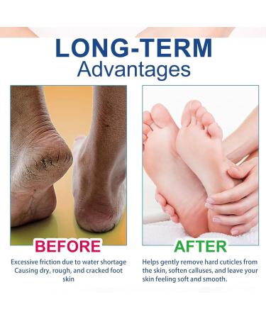 Moisture Level Urea 42% Foot Cream Cracked Heel Repair Cream for Feet And Hand Foot Cream for Cracked Heels And Dry Skin Foot Care Cream Deep Hydrating & Smooth Dull Skin Remover Foot Cream - Buy Online on GoSupps.com