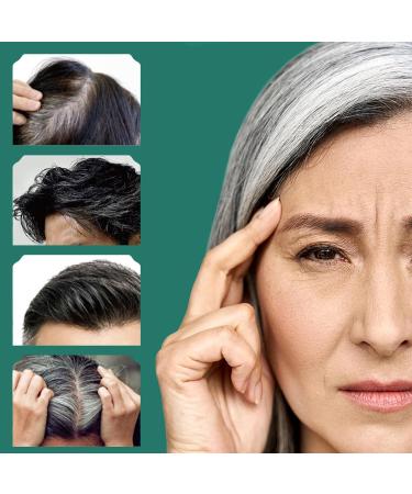  Generisch Hair coloring shampoo - 207 ml - For hair coloring - Light coverage - For women the elderly curly hair beards travel for - Buy Online on GoSupps.com