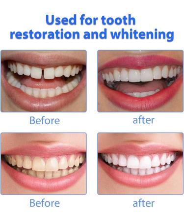 4-Piece Plug-In Dentures - Whiten & Brighten Your Smile | Unisex False Teeth for Imperfect Smiles - Buy Online on GoSupps.com