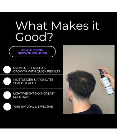 Hair Growth Spray for Thinning Hair - Regrowth Treatment for Men & Women with Castor Rosemary & Argan Oil - Strengthens & Thickens - Made in USA - 4 Fl Oz - Buy Online on GoSupps.com