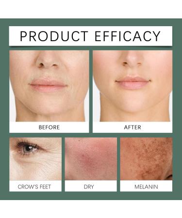 Paracress Facial Oil Paracress Oil Paracress Facial Serum Organic Paracress Oil Vegan Natural Skincare for Face Suitable for All Skin Types (30ml) - Buy Online on GoSupps.com