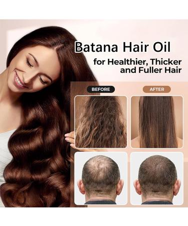 Hair Butter with 100% Pure Raw Batana Oil Batana Oil for Hair Growth Repair Damaged Hair Natural Hair Growth Oil Effective Against Regional Alopecia Hair Growth Butter for All Hair Types - Buy Online on GoSupps.com