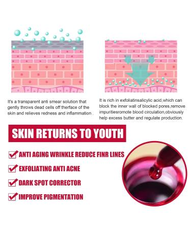 AHA 30% + BHA 2% Peeling Solution - Exfoliating Serum for Blemishes Pore Congestion & Fine Lines | 30ml International Shipping - Buy Online on GoSupps.com