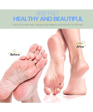 Maryton Foot Scrubber Pumice Stone 2-in-1 Exfoliating Pedicure Tool - Dead Skin Callus Remover - 2-Pack - Buy Online on GoSupps.com