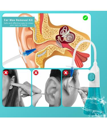 Qumox Ear Wax Removal Kit - Safe & Effective Manual Ear Irrigation System for Built-Up Wax Removal - Buy Online on GoSupps.com