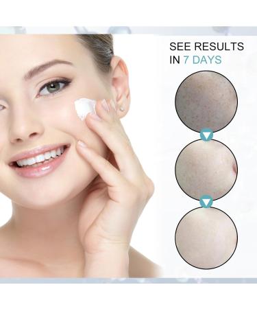 KOAHDE Black Spot Removing Cream Whitening and Freckle Removing Face Cream Spot Lightening Face Cream Dark Spot Corrector Creams Dark Spot Removing Moisture Cream Spot Skin Repairing Face Cream - Buy Online on GoSupps.com