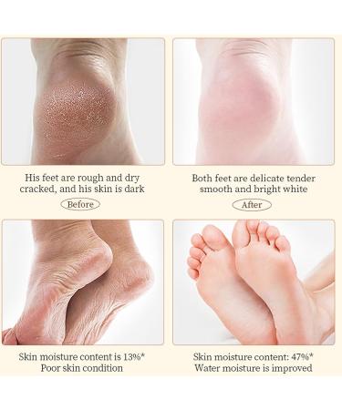 Cracked Heel Repair Cream For Feet and Hand Foot Cream Athletes Foot cream Foot Cream for Dry Skin Deep Moisturizing Callus Remover & Soften Hard Skin Callus Remover Hard Skin Remover Foot Cream - Buy Online on GoSupps.com