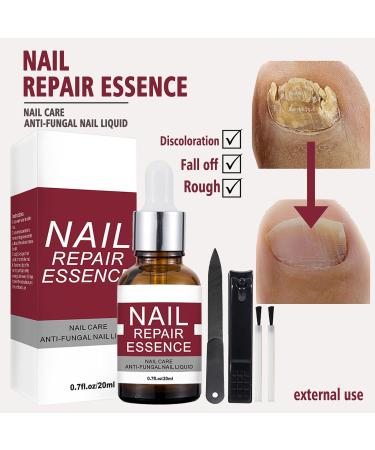 Extra Strong Fungal Nail Treatment - Nail Fungus Remover Kit with File and Brush - 20ml - Buy Online on GoSupps.com