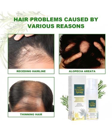 60ml Hair Growth Serum Women Hair Growth Essential Oil Natural Hair Growth Spray Hair Growth Oil for Hair Loss Hair Loss Treatment for Women Hair Serum for Dry Damaged Hair Hair Oil for Hair Growth - Buy Online on GoSupps.com