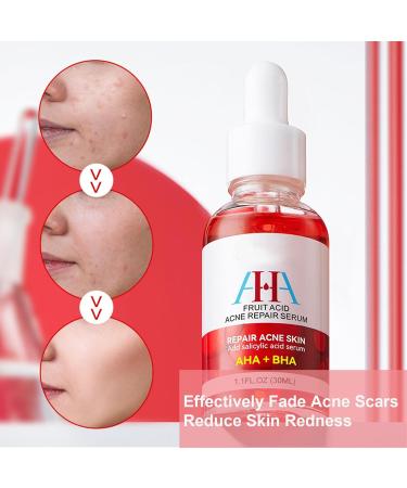 Friut Acid Face Serum for Acne Mark Salicylic Acid Anti Wrinkle Serum Fade Ance Mark & Shrink Pore Face Serum Hyaluronic Acid Acne Repair Serum for Sensitive Skin Smoothing Hyaluronic Serum-30ml - Buy Online on GoSupps.com