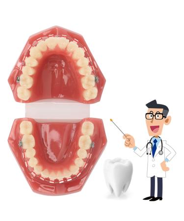 Orthodontic process presentation: tooth orthodontic model with metal wires and holder for teaching and learning simulated tooth structure and orthodontic