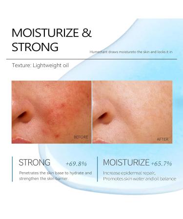 Lapis Blue Tansy Face Oil | Hydrating Skin Serum with Jojoba Oil | Moisturizing Plant Essence | 1 oz for Balanced Skin - Buy Online on GoSupps.com