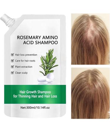 Hair Loss Shampoo for Women Strengthening Plant Shampoo for Thinning Hair Natural Strengthener for Dry Oily Damaged Fine Curly Long Short Sensitive Hair Home Shower Travel - Buy Online on GoSupps.com