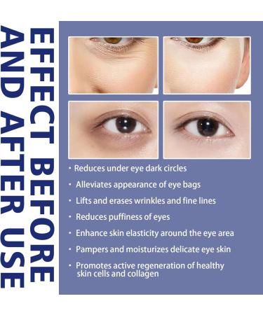 JAYSUING Eye Cream Against Dark Circles Active Ingredient Combination Kaluofan 2 Pieces Active Eye Cream Makes Dark Circles and Fade Symptoms Eliminates Fine Lines Eye Bags - Buy Online on GoSupps.com