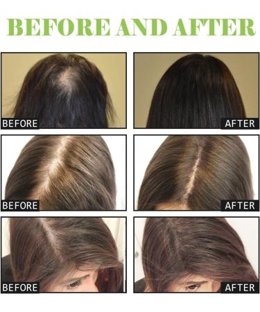 Utapossin Hair growth shampoo antihair loss shampoo hair growth and conditioner against hair loss for faster hair regrowth prevents hair loss - Buy Online on GoSupps.com