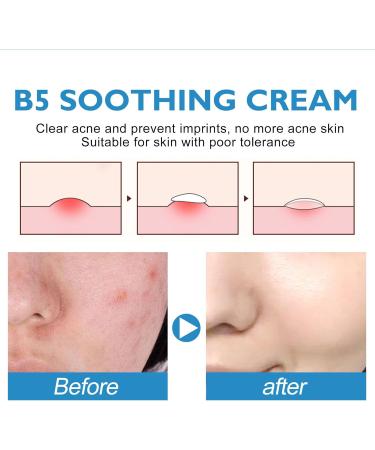 Soothing B5 Repair Cream B5 Moisturizing Repair Cream Moisturizing skin care face cream B5 Skin Repair Cream Sensitive Skin Soothing B5 Facial Cream Face Moisturizer For Women & Men - Buy Online on GoSupps.com