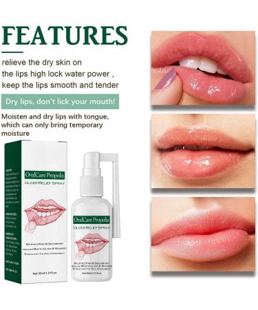 Mouth Ulcer Treatment Spray Mouth Ulcer Treatment for Adults Canker Sore Treatment Oral Care Spray Herbal Mouth Spray Canker Sores Relief Spray for Mouth Ulcer Bad Breath Treatment Mouth Freshener - Buy Online on GoSupps.com
