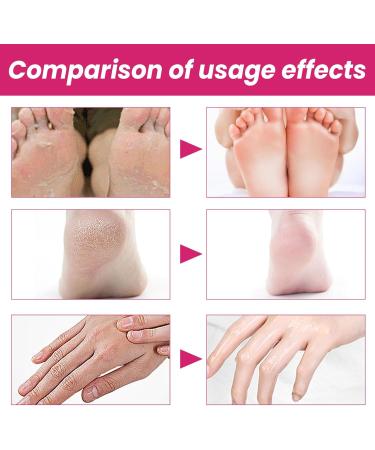 Pedicure Socks Comfortable Anti Slip Full Coverage Foot Care Moisturizing Socks Reusable for Dry Cracked Feet - Buy Online on GoSupps.com