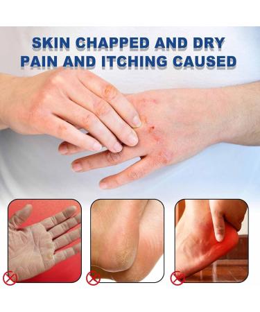 Moisture Level Urea 42% Foot Cream Cracked Heel Repair Cream for Feet And Hand Foot Cream for Cracked Heels And Dry Skin Foot Care Cream Deep Hydrating & Smooth Dull Skin Remover Foot Cream - Buy Online on GoSupps.com