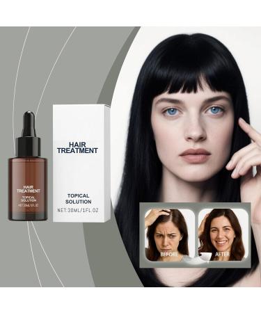 wiroouia Hair Growth for Women 50g Scalp Moisturizing Care Solution Thickening Antithinning for Daily Shower Damaged Curly Dry Thinning Hair Women Men Home Bathroom - Buy Online on GoSupps.com