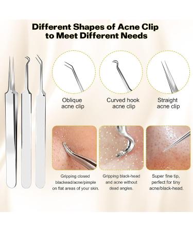 iSmartPart 20Pcs Blackhead Remover Tools Kit - Professional Stainless Steel Acne Extraction Set for Face and Nose - Buy Online on GoSupps.com