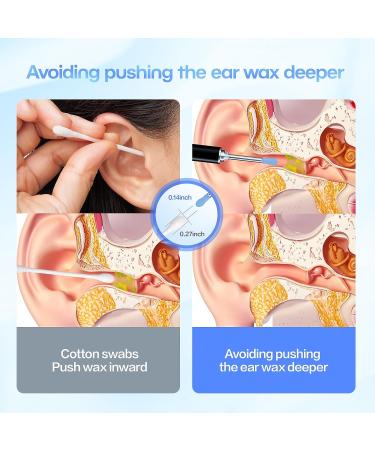 Aeasycozy Ear Wax Removal Kit with 3 Million Pixel 1296P HD Camera - Wireless Ear Cleaner with 6 LED Light & 4 Ear Sleeve Set - Buy Online on GoSupps.com
